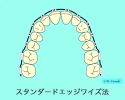 スタンダードエッジワイズ法