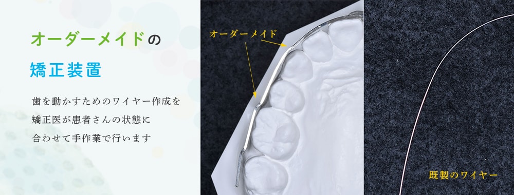 オーダーメイドの矯正装置